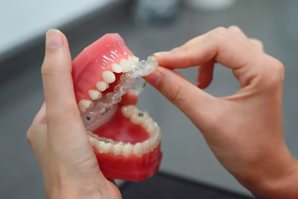 Can Adults Get Braces